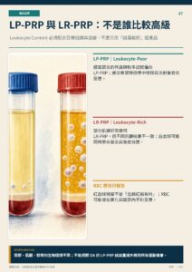 LP-PRP 與 LR-PRP：不是誰比較高級｜衛教資訊圖