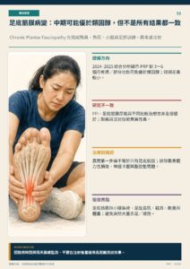 足底筋膜病變：中期可能優於類固醇，但不是所有結果都一致｜衛教資訊圖
