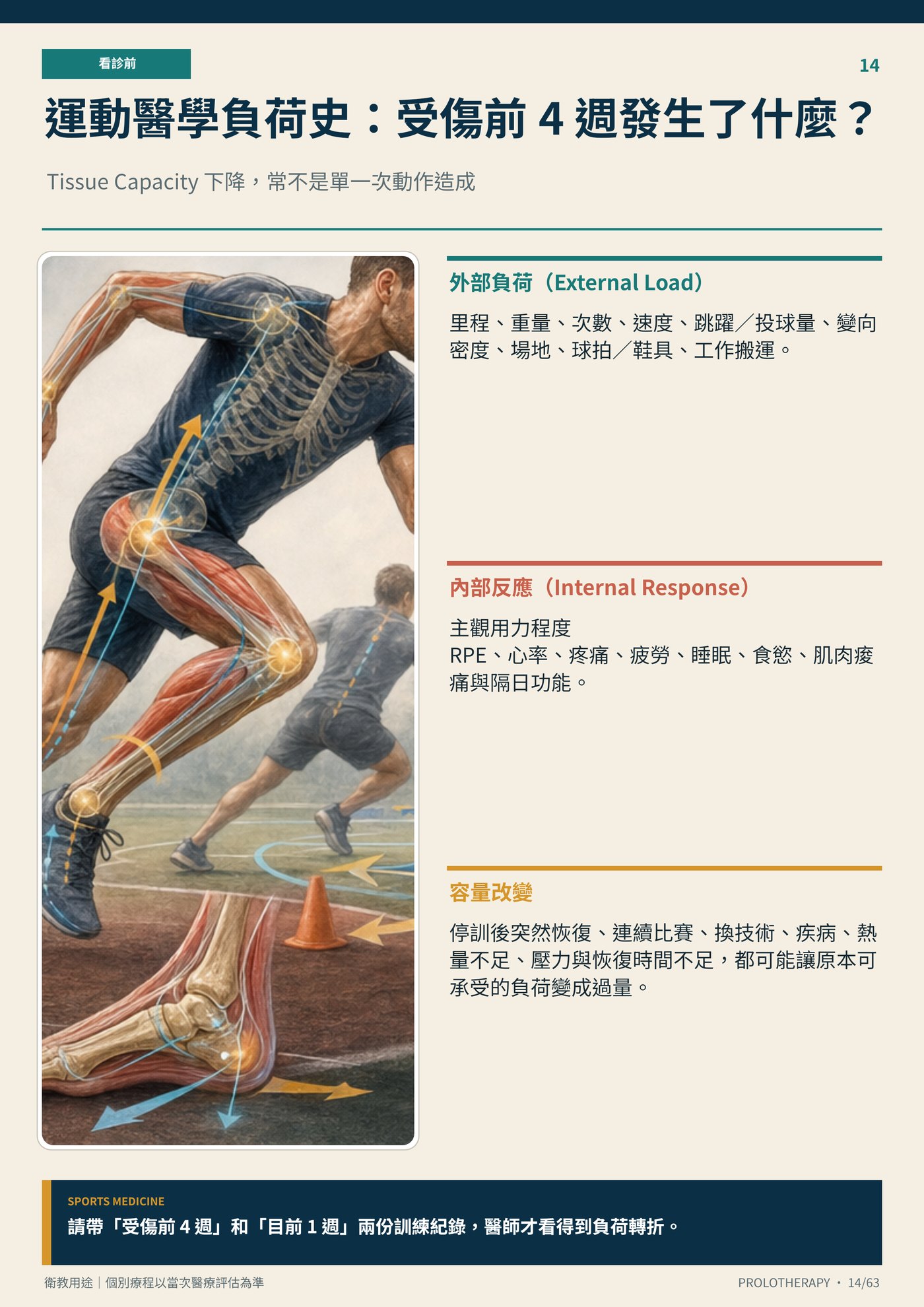 運動醫學負荷史：受傷前 4 週發生了什麼？｜衛教資訊圖