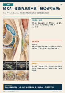 膝 OA：關節內注射不是「把軟骨打回來」｜衛教資訊圖