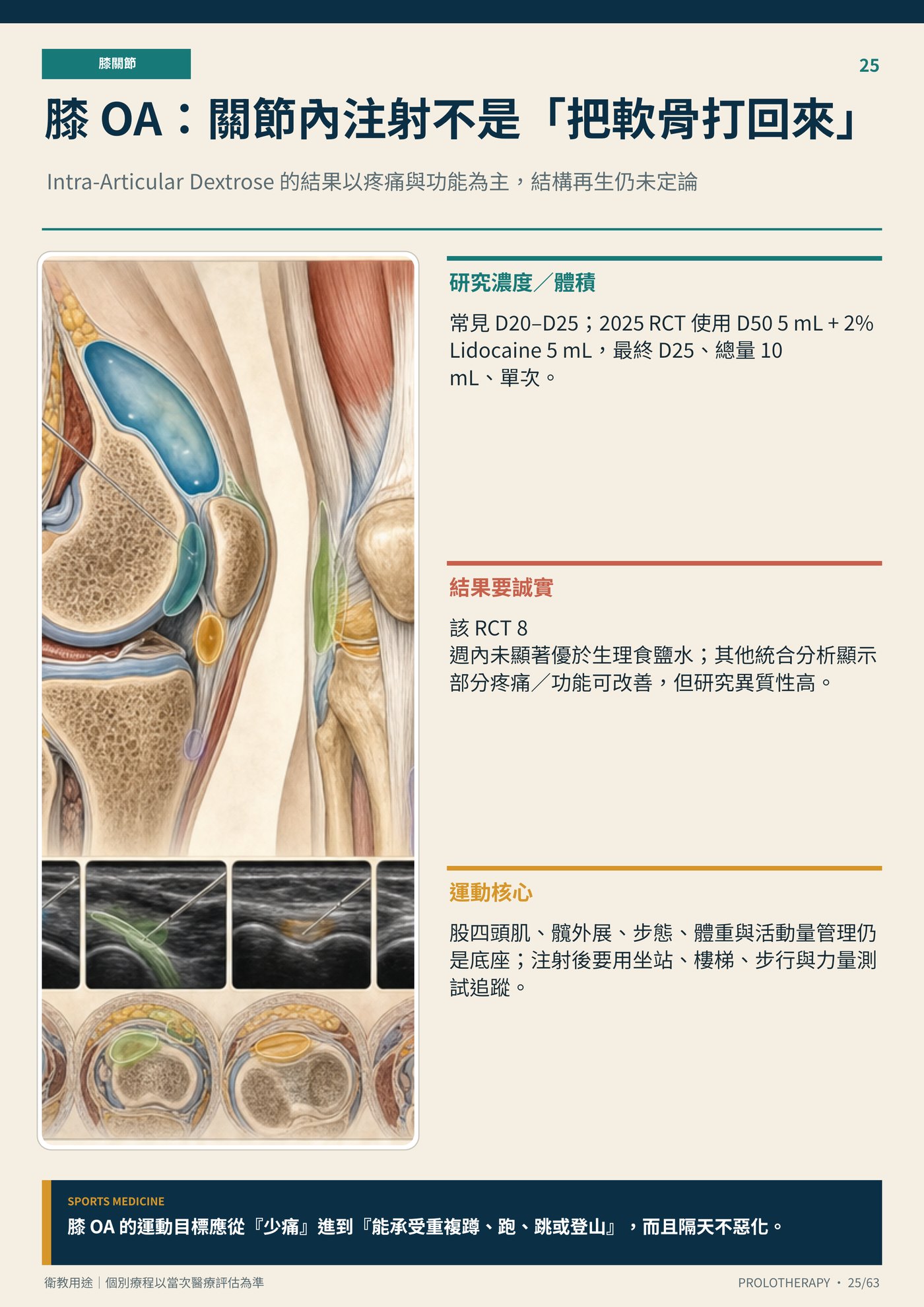 膝 OA：關節內注射不是「把軟骨打回來」｜衛教資訊圖