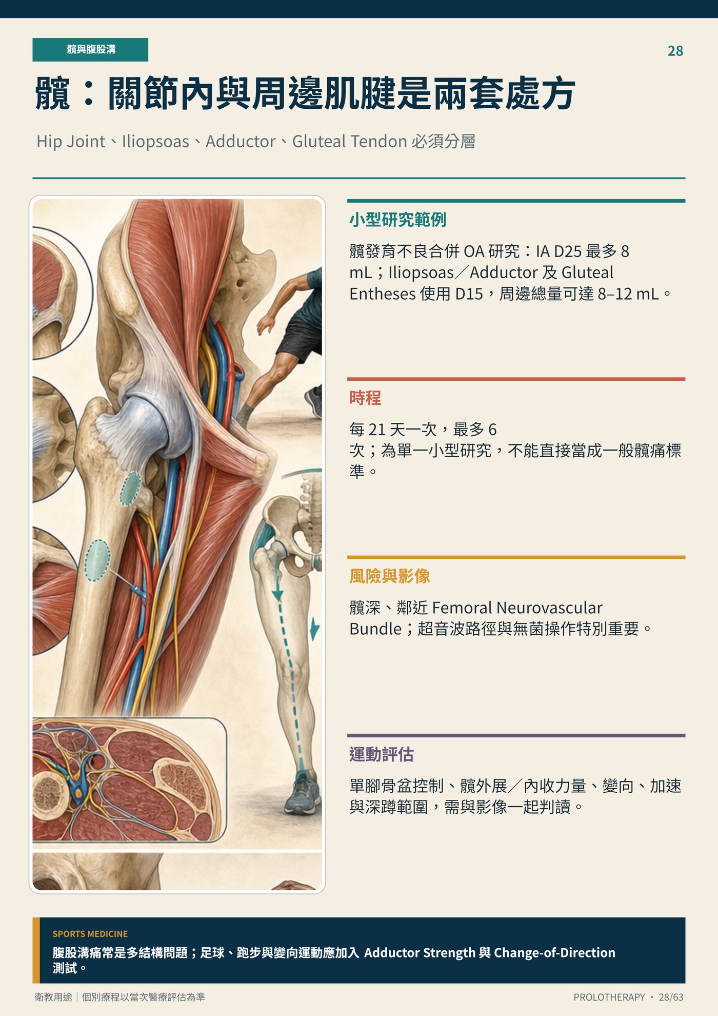 髖：關節內與周邊肌腱是兩套處方｜衛教資訊圖