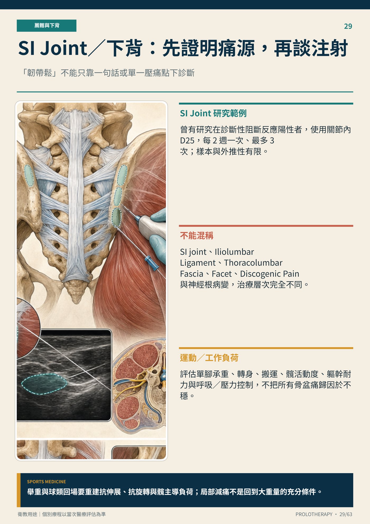 SI Joint／下背：先證明痛源，再談注射｜衛教資訊圖