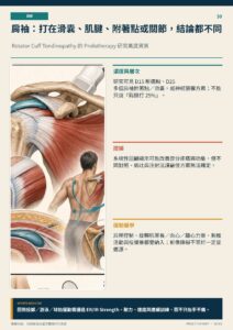 肩袖：打在滑囊、肌腱、附著點或關節，結論都不同｜衛教資訊圖