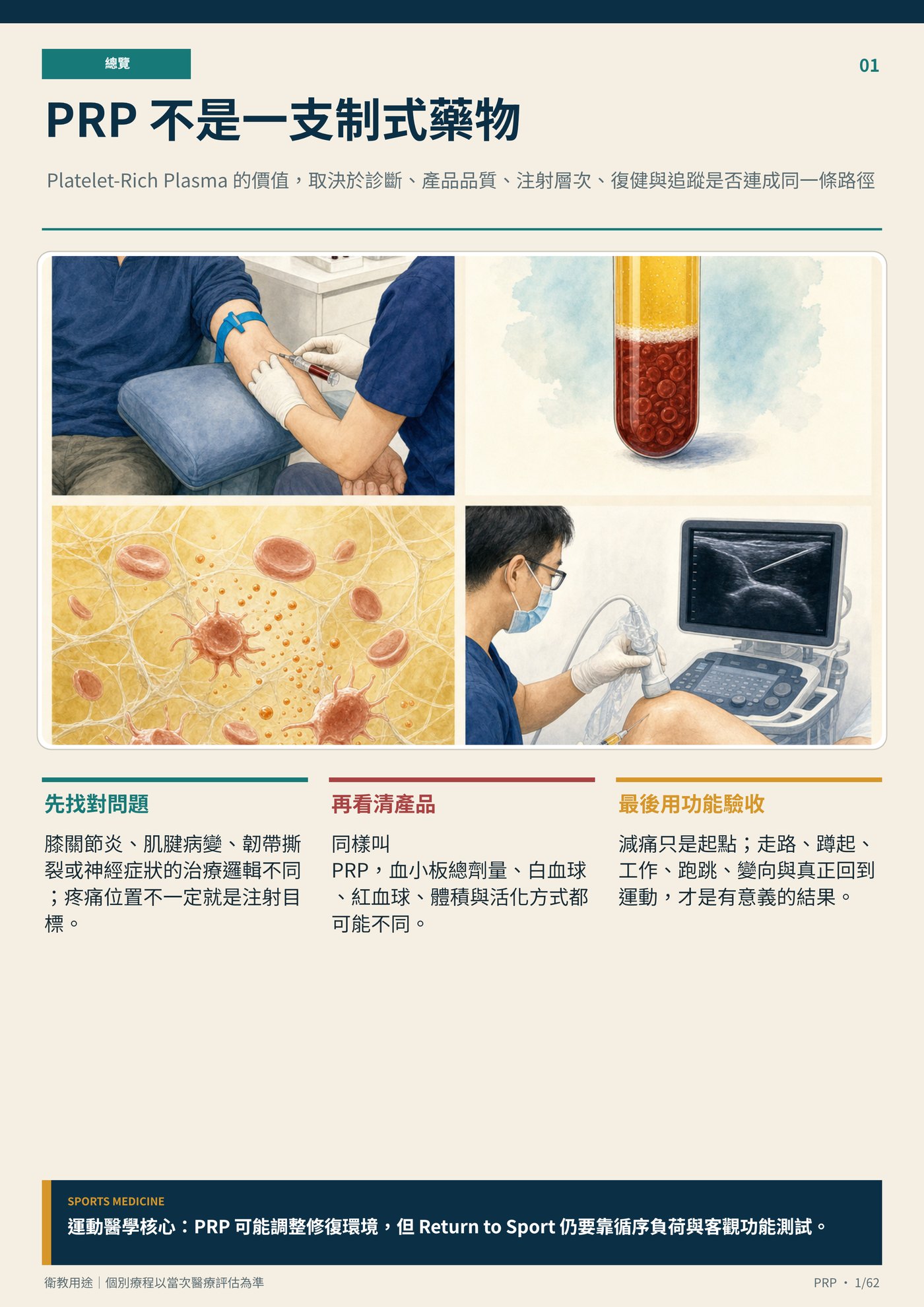PRP 不是一支制式藥物｜衛教資訊圖