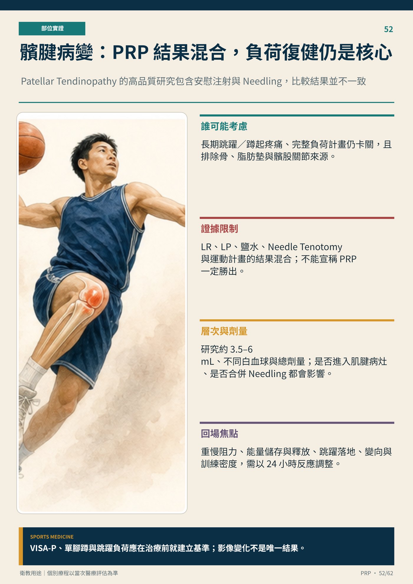 髕腱病變：PRP 結果混合，負荷復健仍是核心｜衛教資訊圖